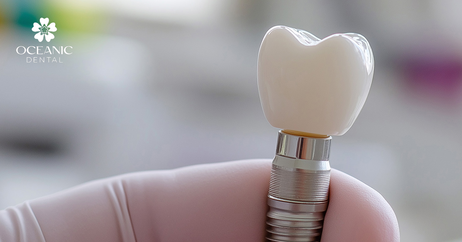 Dental implant with a crown Oceanic Dental